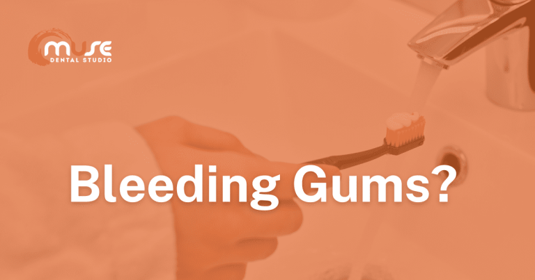 Are Bleeding Gums A Problem?