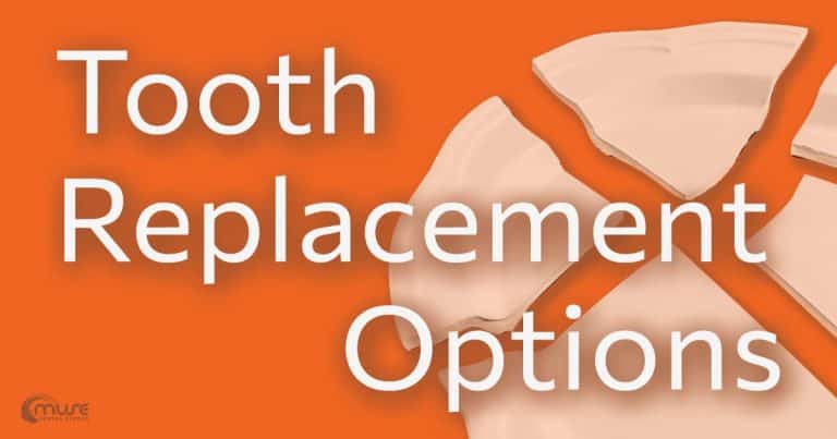 Blog banner: Missing Teeth